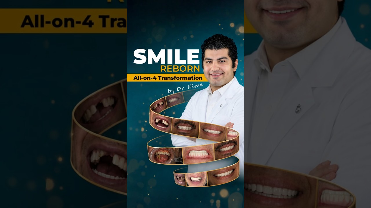 Can All-on-4 Restore Your Smile?