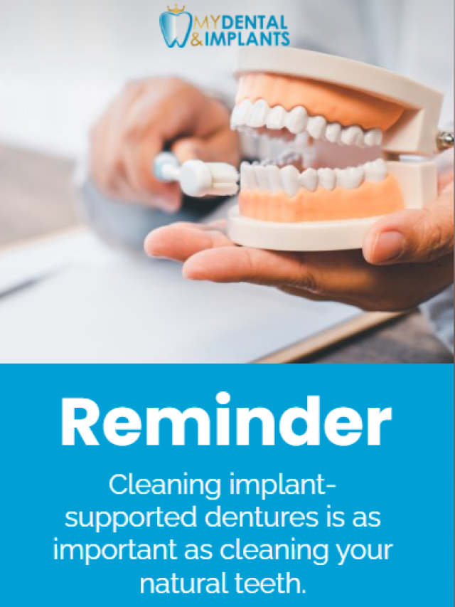 Reminder cleaning implant-supported dentures