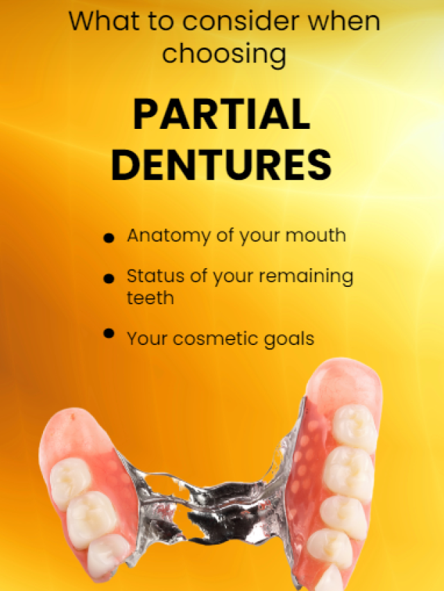 What to consider when choosing Partial Dentures Cover