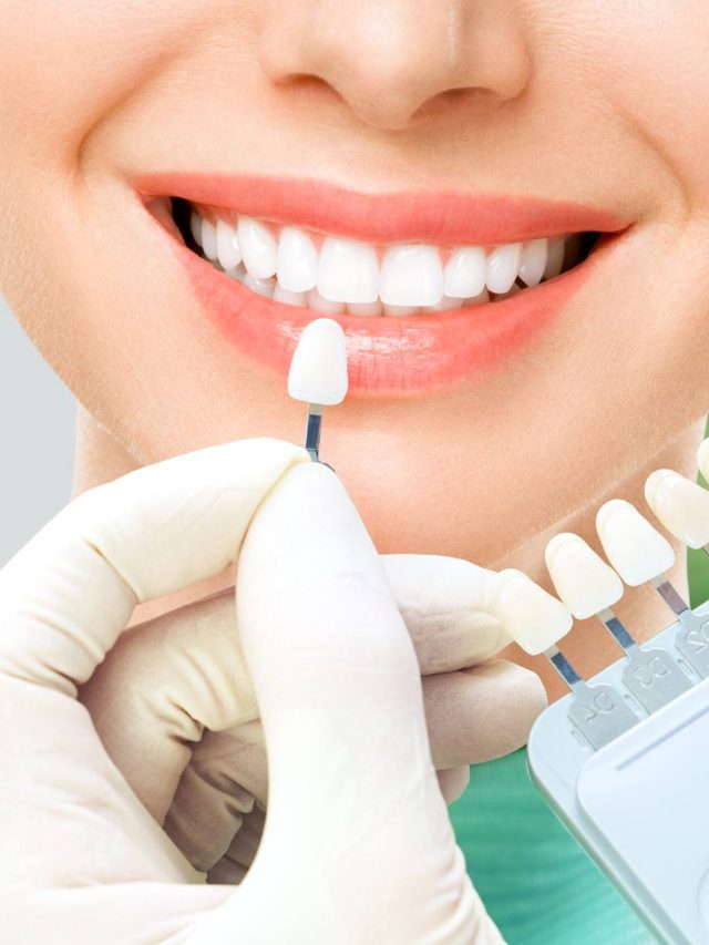 Dental Veneers – For a picture perfect smile