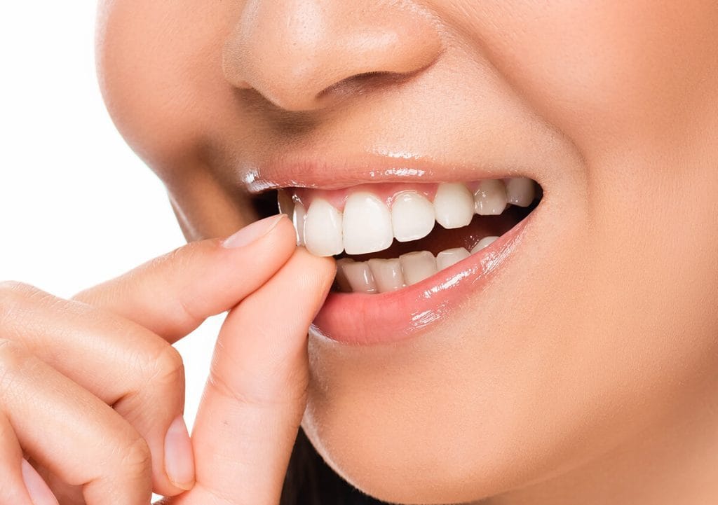 Veneers Dentist in Glendale Arizona Area