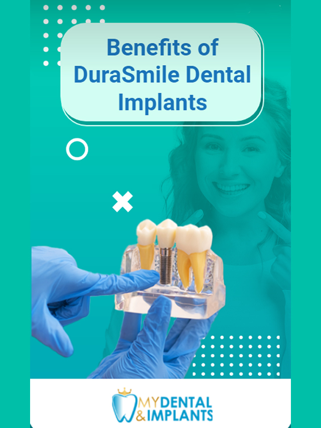 Benefits of DuraSmile Dental Implants Webstory Poster