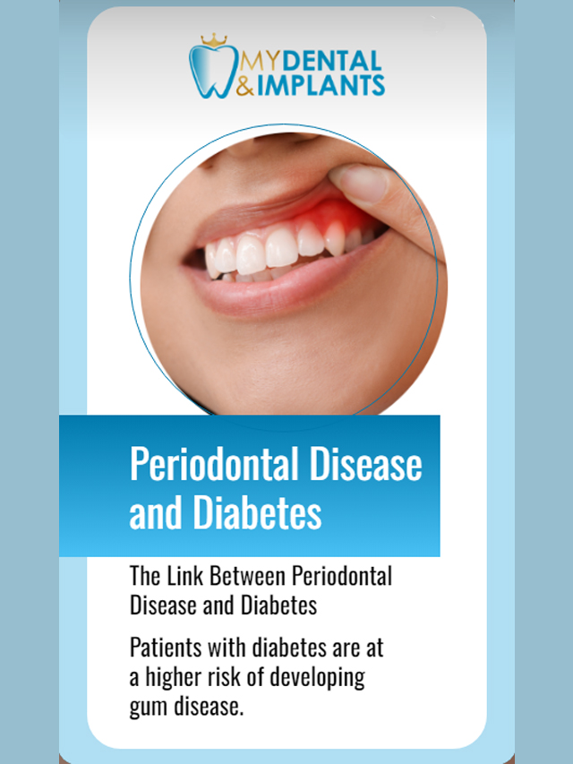 The Link Between Periodontal Disease and Diabetes Poster Image