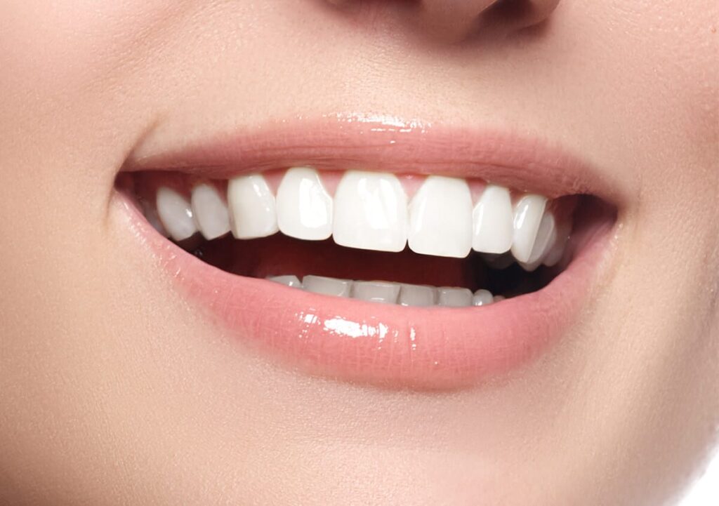 Benefits of Dental Implants