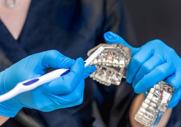 Signs You May Need a Full Mouth Dental Implant Solution